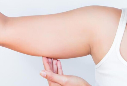 Picture of a woman facing the camera and happy with the perfect arms liposuction procedure she had with top plastic surgeons in beautiful Cancun, Mexico.  She is wearing a white top and holding her hand to one arm,  showing the area of the surgery.